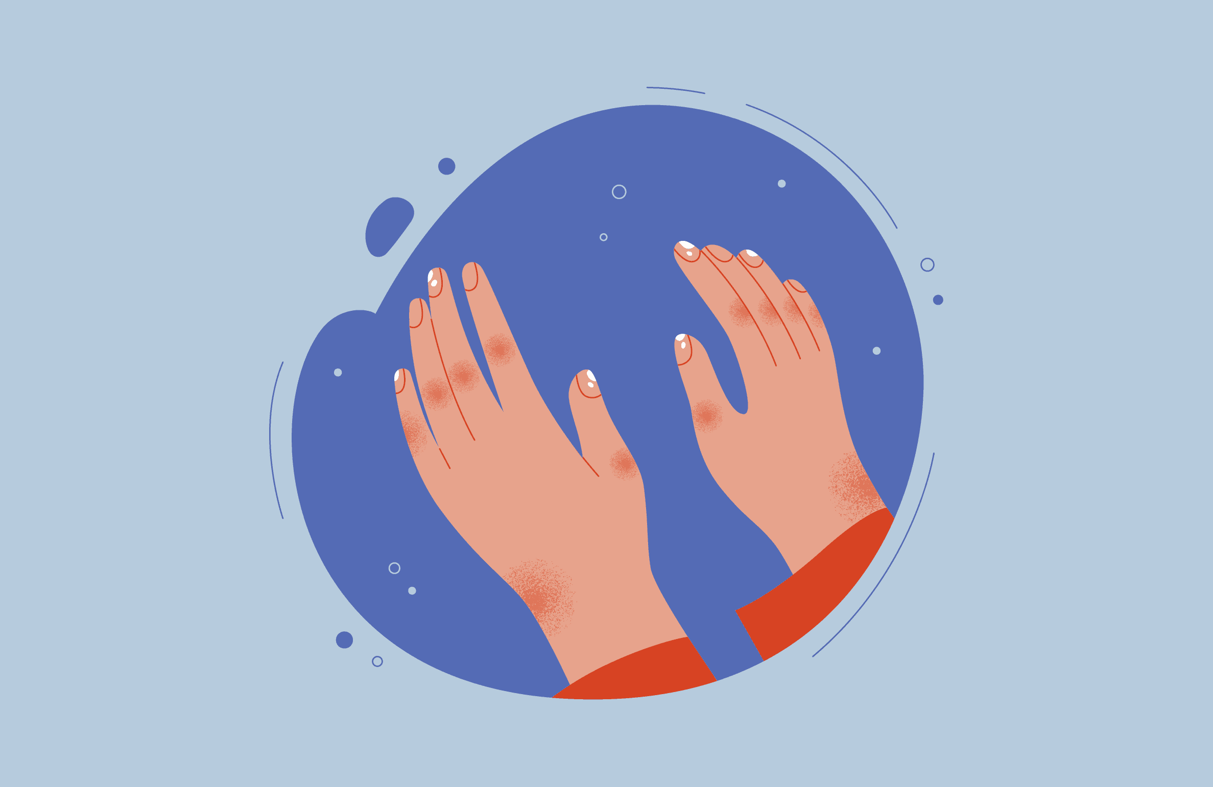 Лечение кожи и ногтей при псориатическом артрите