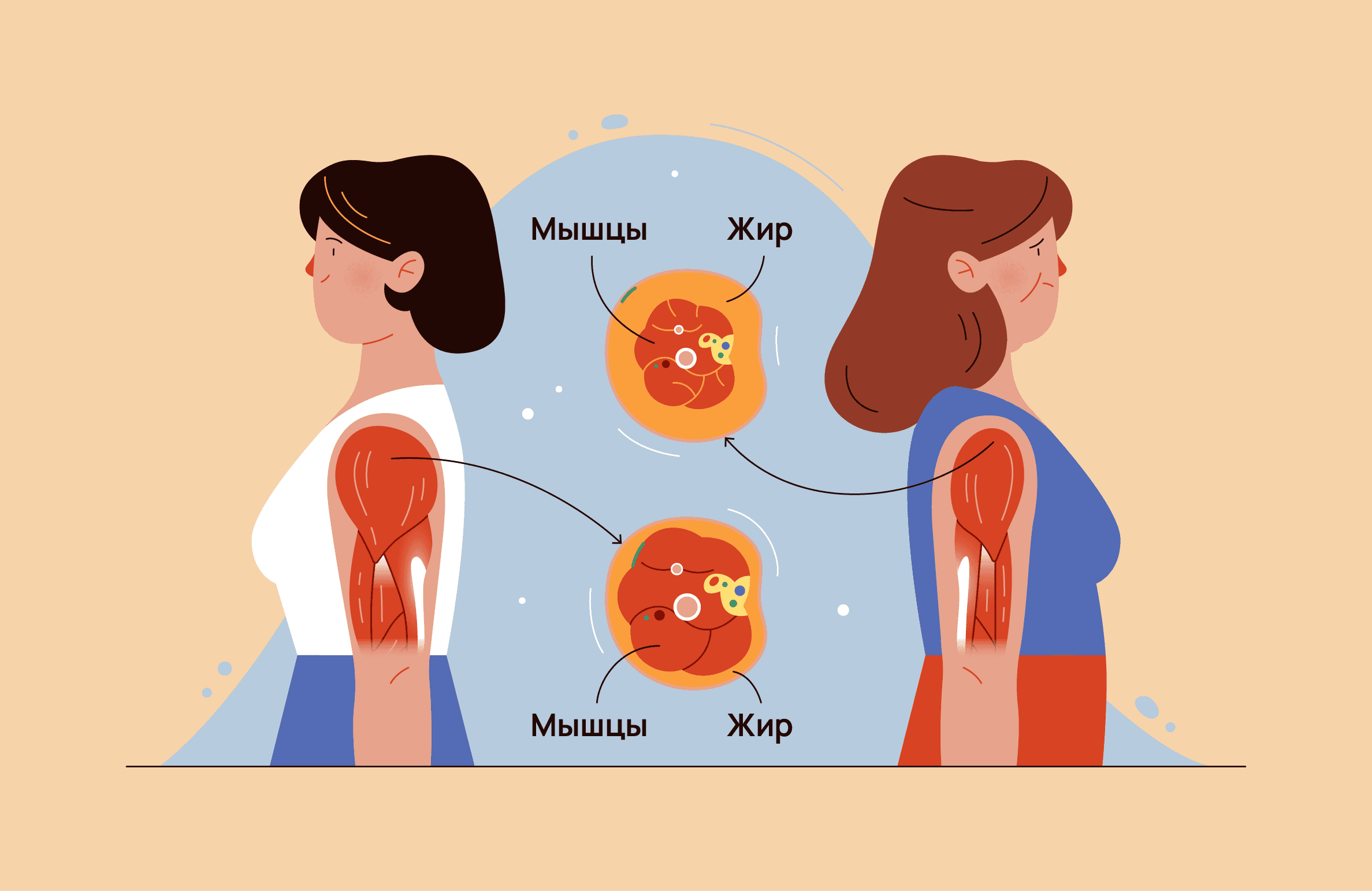 Мышечная атрофия при ревматоидном артрите: всё про ревматоидную саркопению