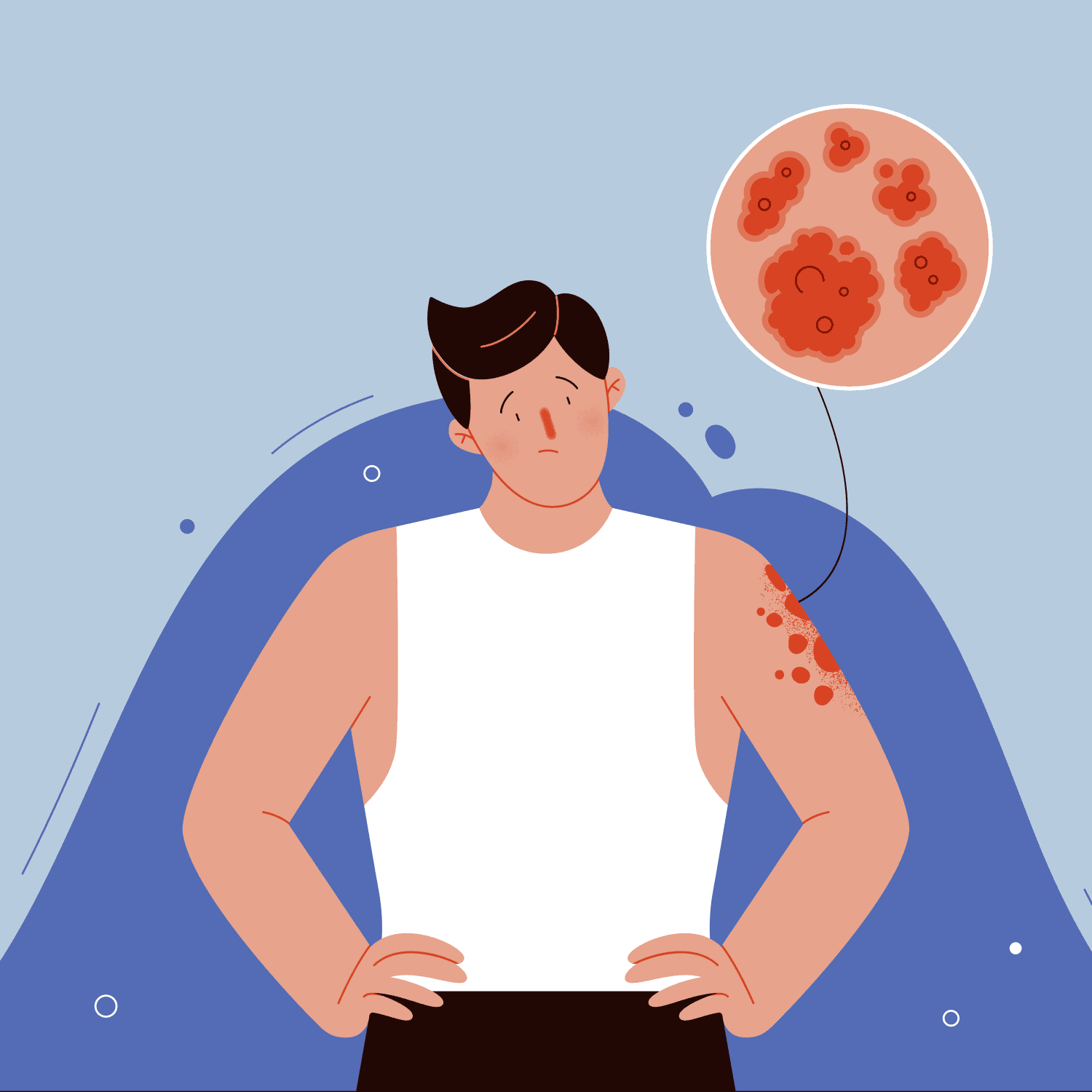 Как ухаживать за кожей с псориазом