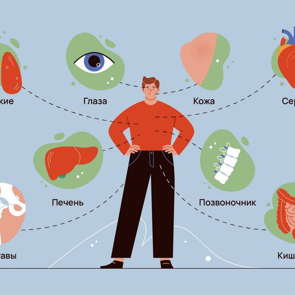 Какие заболевания и осложнения сопутствуют псориатическому артриту?