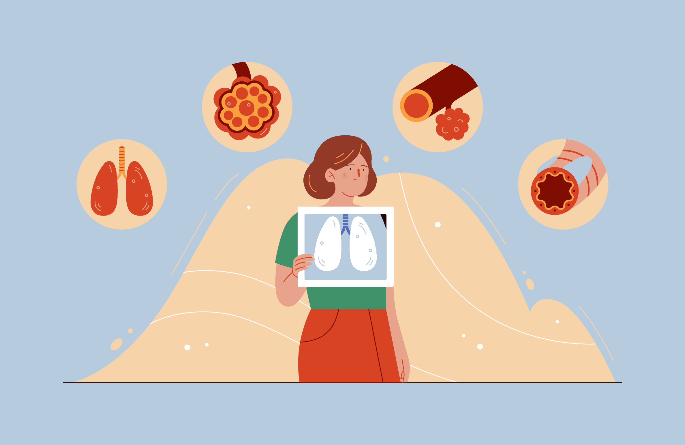 Поражение дыхательной системы при системной склеродермии